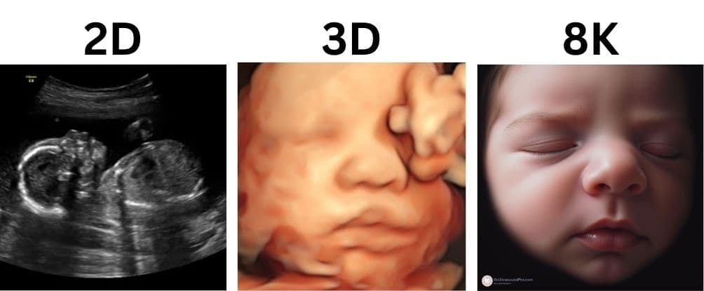Comparison of different ultrasound technologies