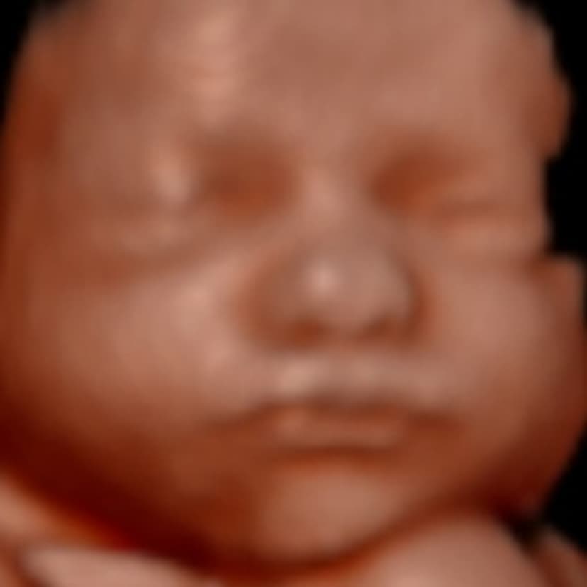 Original ultrasound image